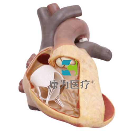 萍乡“康为医疗”完全性大动脉错位模型