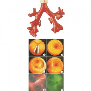 “康为医疗”CLA9/8荧光气管支气管树模型(消化内科技能模型）