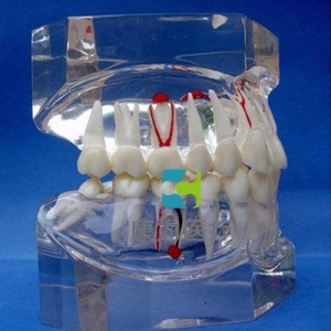 浙江“康为医疗”透明牙体病理模型