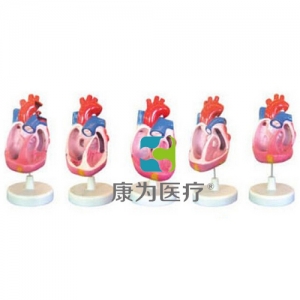 浙江“康为医疗”先天性心脏畸形模型（5部件）