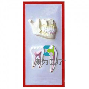 “康为医疗”牙列与牙解剖浮雕模型